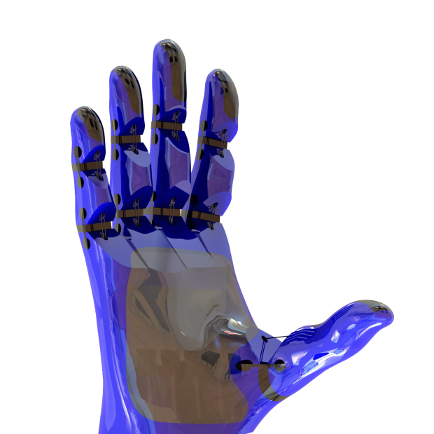 پروتز دست مصنوعی پرینت سه بعدی
